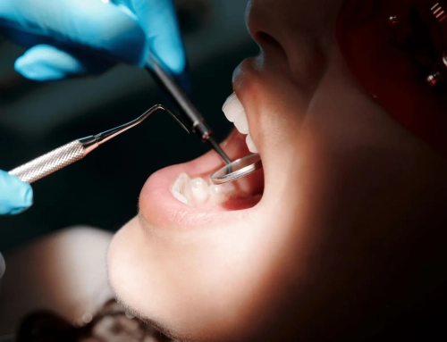 ¿Cuándo fue tu última visita al dentista?
