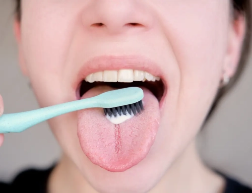 ¿Tienes la lengua blanca? Lo que dice tu boca sobre tu salud